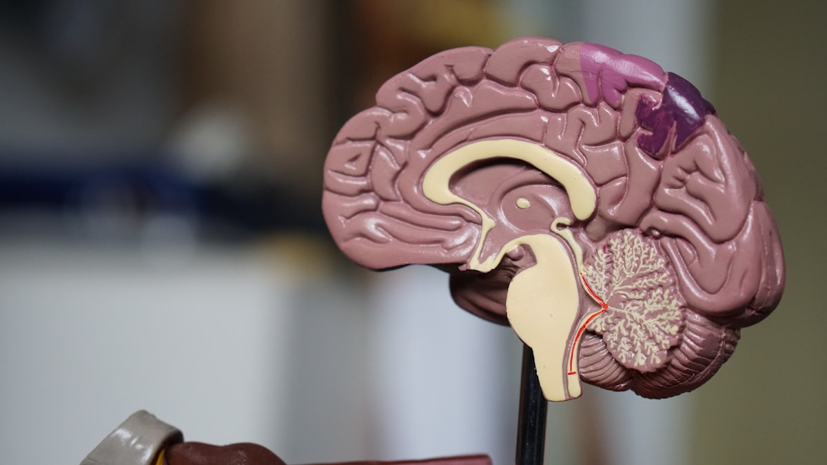 Neurology article